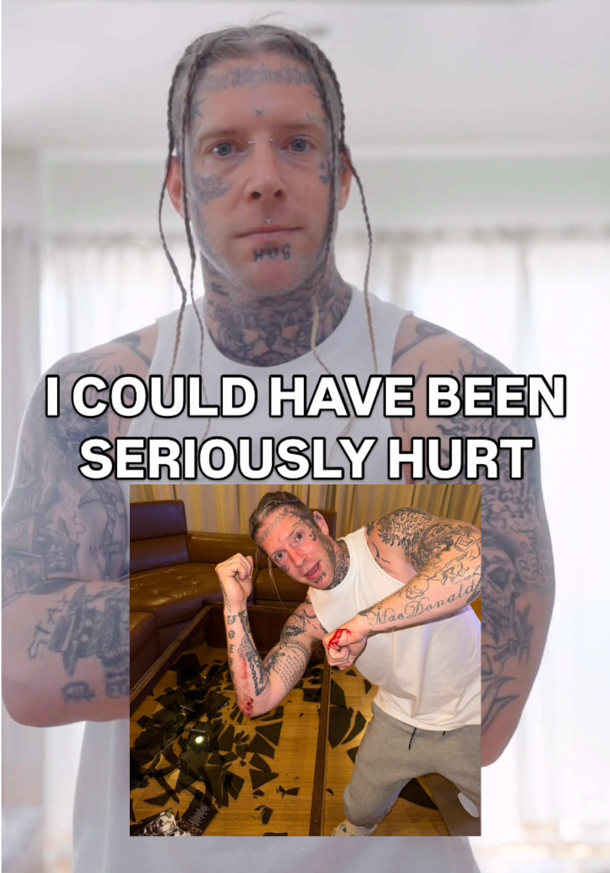 There’s still glass in my elbow 😭 My new albums are HALF gone! Get yours while ya still can! #storytime #fail #artist #fyp #stitch 