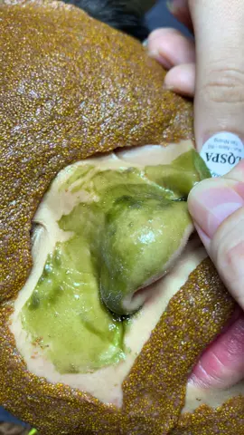 Phê #chamsocdamun#chamsocdaseo#chamsocdanam#tanbinh#Lqspa&academy 