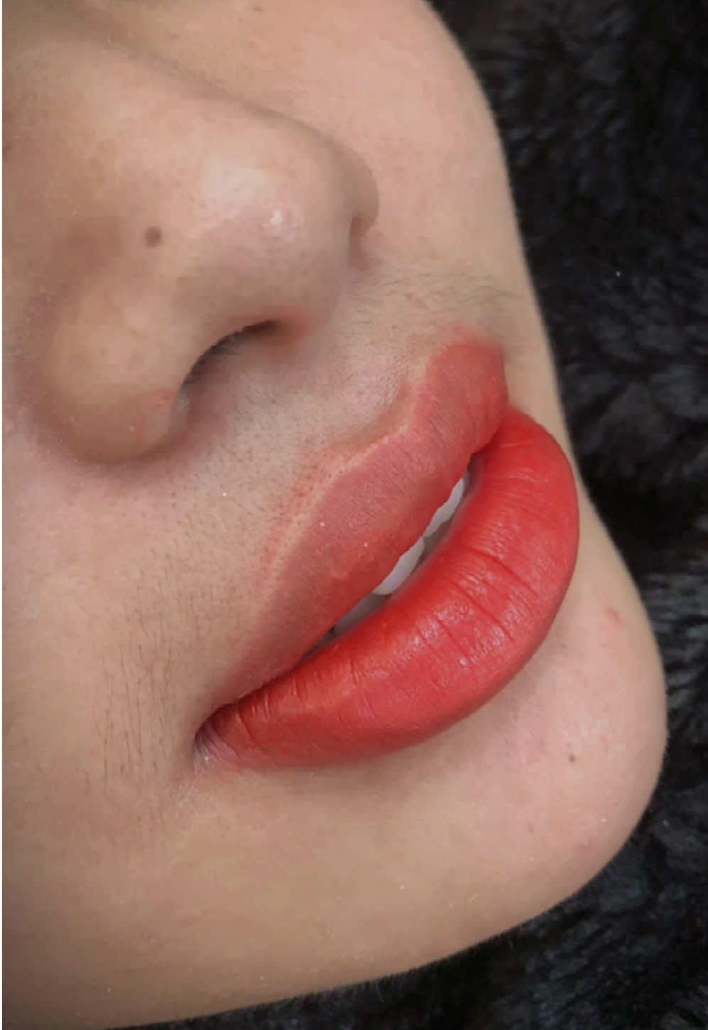 “Môi cực thâm, viền sậm, lại có hạt fodi lấm tấm khắp môi 😣 Nhưng làm xong nhìn khác hẳn — môi hồng tươi, viền mềm, màu lên nhẹ như son dưỡng 💋 Làm đẹp là hành trình, và mỗi ca khó là niềm vui khi thấy khách tự tin trở lại 🥰” 📍“Nếu môi bạn từng phun lỗi, bị thâm hoặc nổi fodi – inbox em kiểm tra nền miễn phí nha 💕”#phunxamthammy #phunxamthammychuyennghiep #eva #moixinhxinh #eva 