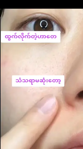 #rosehoneysoap🌹 #ဆား၀က်ခြံအဆီဖုချွေးပေါက်ကျယ်ပြဿနာအတွက် #မှာယူရန်ဖုန်း09260908727 #မြို့ပေါင်300ကျော်အိမ်ရောက်ငွေချေနဲ့ပို့ပေးပါတယ် #၀က်ခြံအမဲစက်ပျောက်ချင်သူများ @Yin Yin @Yin Yin 