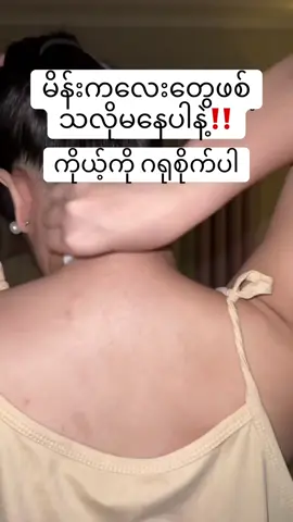 ဂျိုင်း/ဒူး/ဂုတ်/ပေါင်ကြားအကုန်ဖြူ#မဖြူရင်ငွေပြန်အမ်းမယ်🔥 #margoserum #တစ်ခါသုံးတစ်ခါသိသာတယ် #thinkb4youdo #ကြားမှန်သမျှဖြူချင်သူများတွက် 