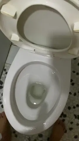 Nước súc miệng 