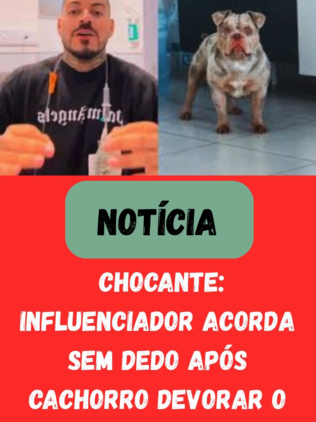 CHOCANTE Influenciador acorda sem dedo após cachorro devorar o membro enquanto dormia      Influenciador cadeirante acorda sem dedo após cachorro American Bully comer o membro enquanto dormia. Sem sensibilidade nas pernas, ele só percebeu ao ver o sangue. Mesmo assim, perdoou o pet! 😱🐕 #HistóriaReal #CachorroComeuDedo #HistóriaChocante #InfluenciadorBrasileiro #ViralAgora #AcidenteBizarro