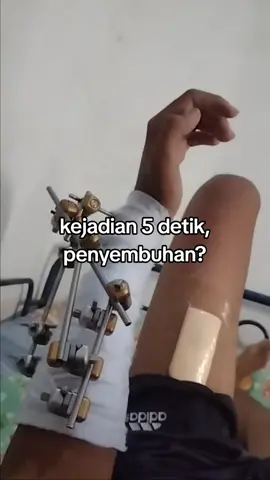 bismillah sembuh☺️ #kembalikuat #patahtulang #pejuangfatkhur #fyppppppppppppppppppppppp 