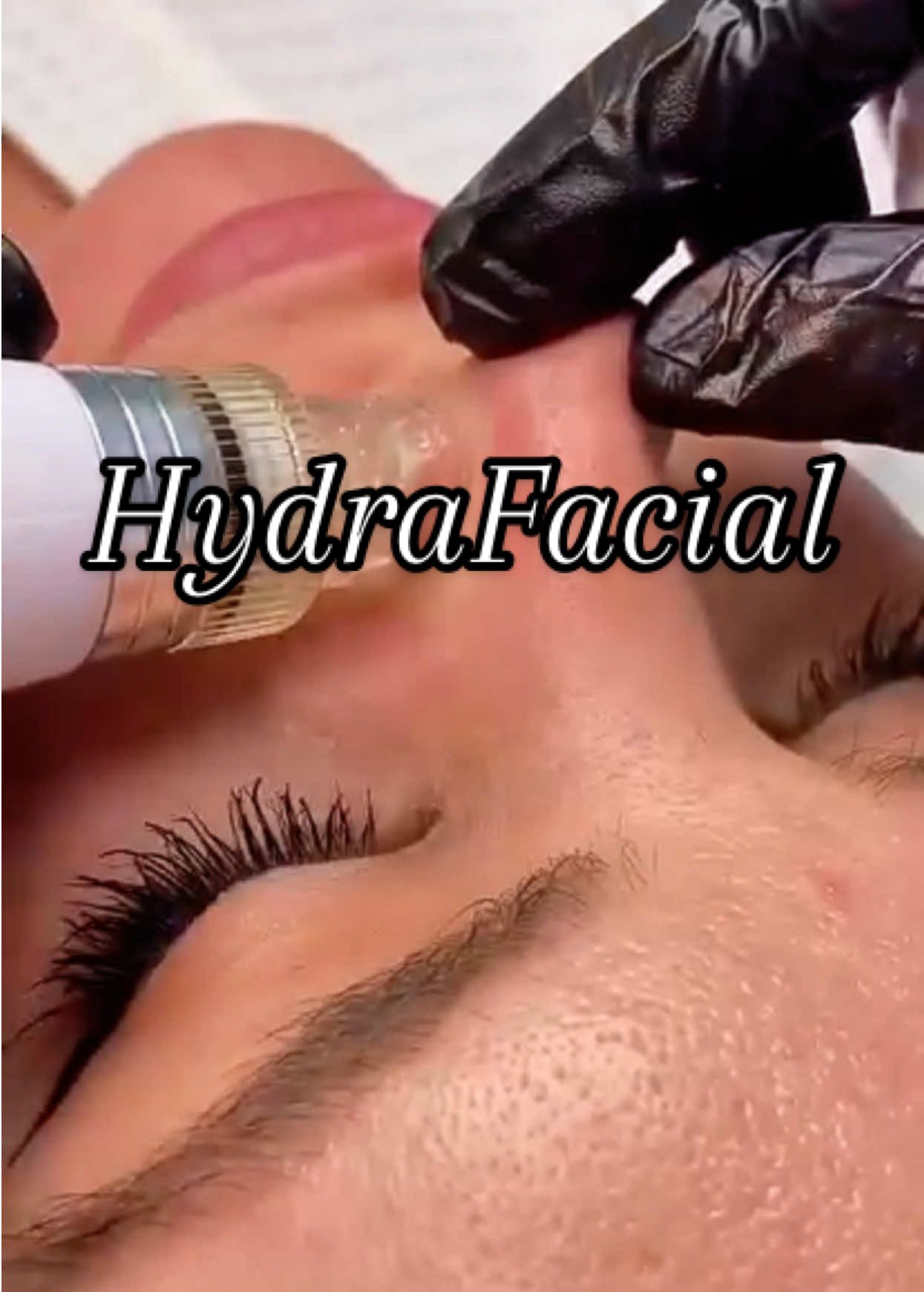 ✨ HydraFacial Deep Glow in One Treatment ✨ It’s time to refresh and revive your skin at Samui Beauty Club – One Stop Beauty Destination in Koh Samui 🌴💕 HydraFacial provides: ✔️ Deep cleansing ✔️ Gentle exfoliation ✔️ Extraction of blackheads & congestion without irritation ✔️ Infusion of intensive serums for plump, hydrated skin ✔️ Visible radiance from the very first session Suitable for all skin types, even sensitive skin 🌸 Perfect before an event or after long days under the sun for an instant glow! #hydrafacial #hydrafacialtreatment #hydrafacialresults #hydrafacialglow #hydrafacialexperience