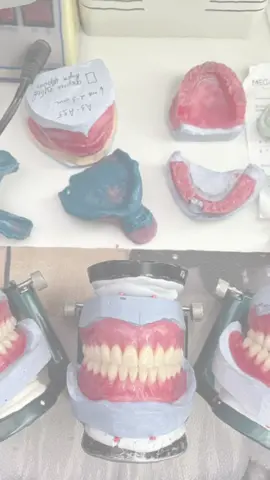 #gigipalsu #dentalbekasi #promogigipalsu #dentalcikarang #fyp 