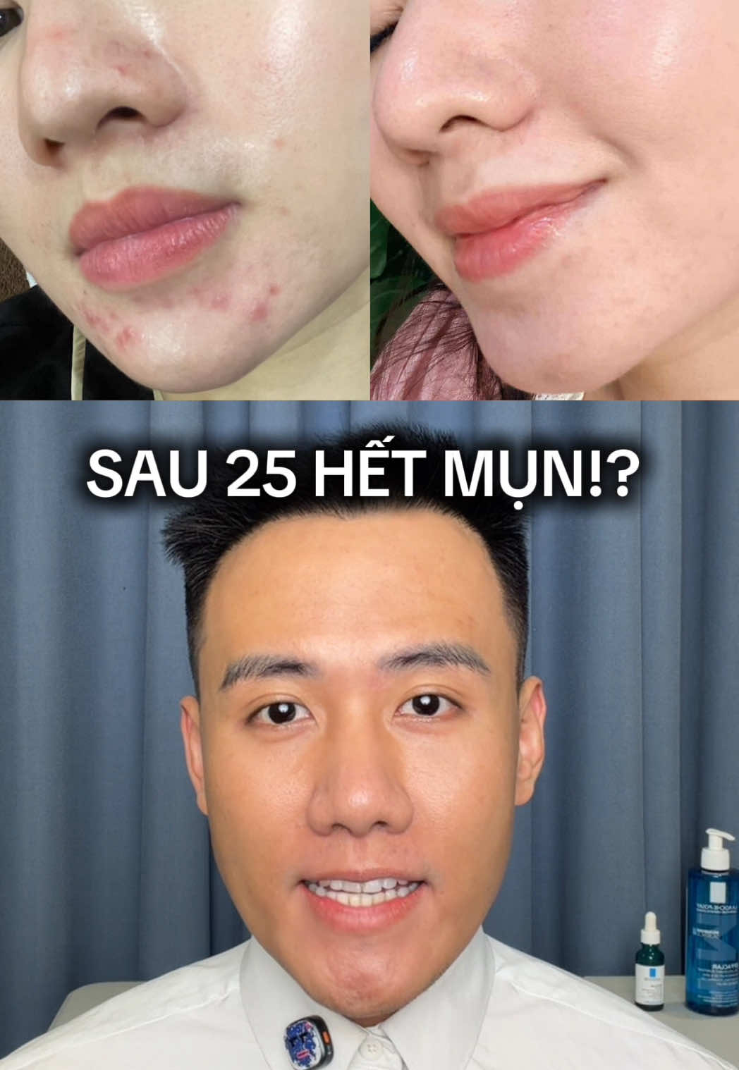 Sau 25 tuổi, mụn không tự biến mất 🫠 chỉ có chăm sóc da đúng cách mới giúp giảm mụn hiệu quả và giữ da khỏe lâu dài 😉 #effaclar #HợpTácCùngLarocheposay  #TikTokFinds #chamsocda #giammun 