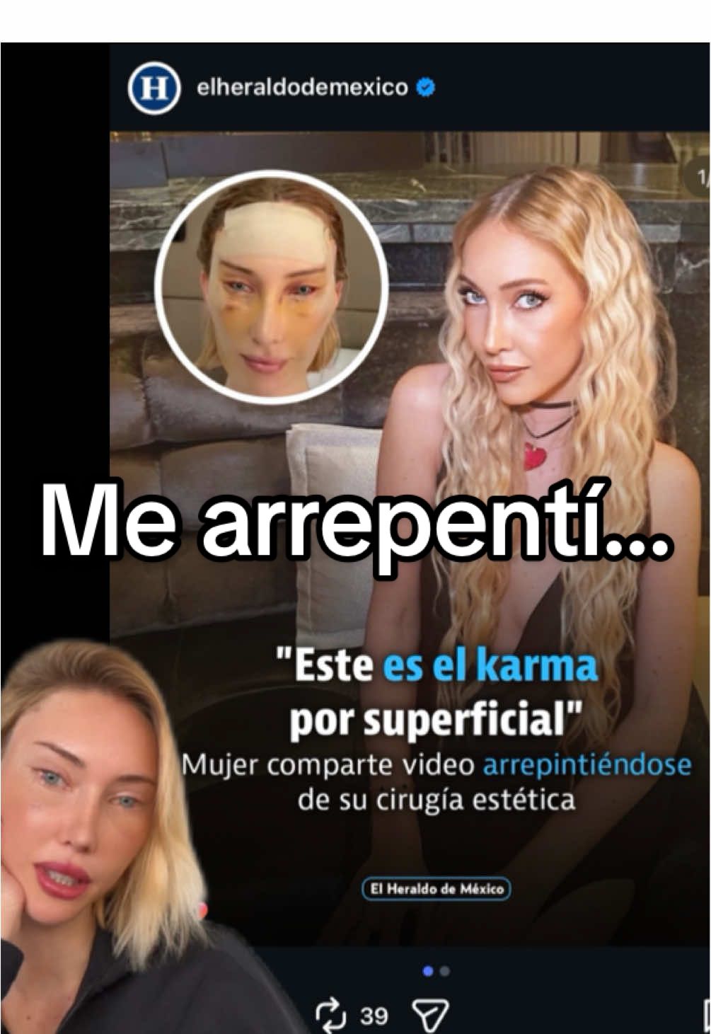 me arrepentí?  #fyp #postoperatorio #foxyeyes #blefaroplastia #lifting 
