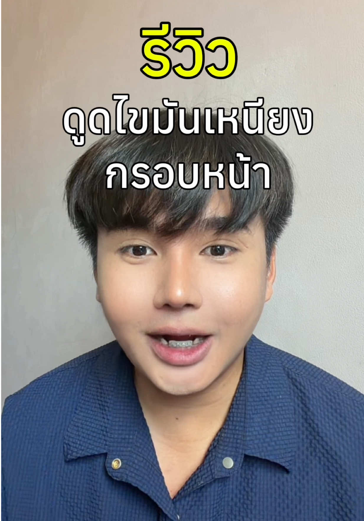 6 เดือนแล้ว #ดูดไขมันเหนียง @บอบอ🐻  @Masterpiece Hospital  @หมอฟลุ๊ค ดูดไขมัน @พี่ดาวที่ไม่ใช่หมอดาว @Line ID : @lipomasterpiece 