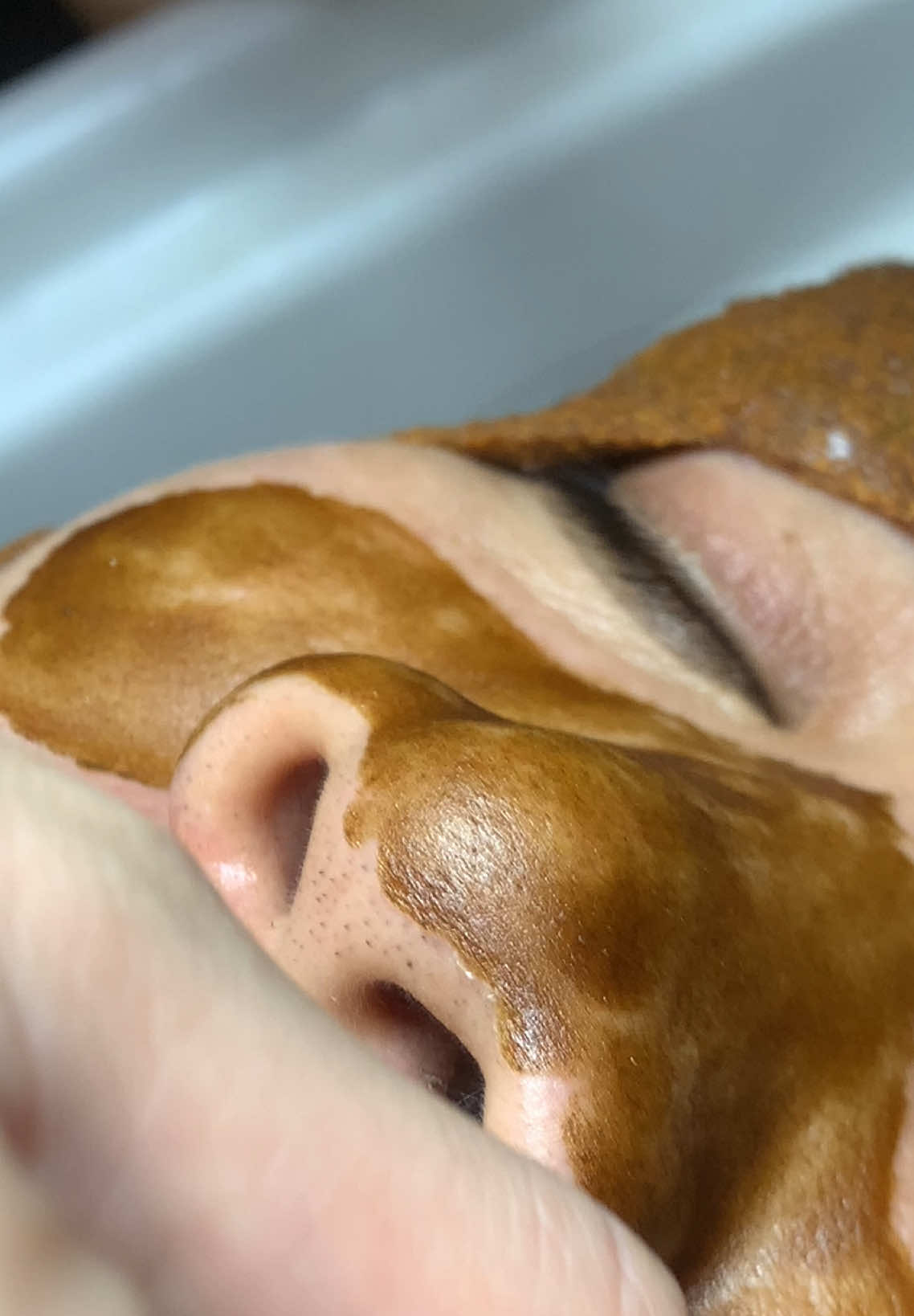 Ngon #chamsocdamun#chamsocdaseo#chamsocdanam#tanbinh#Lqspa&academy 