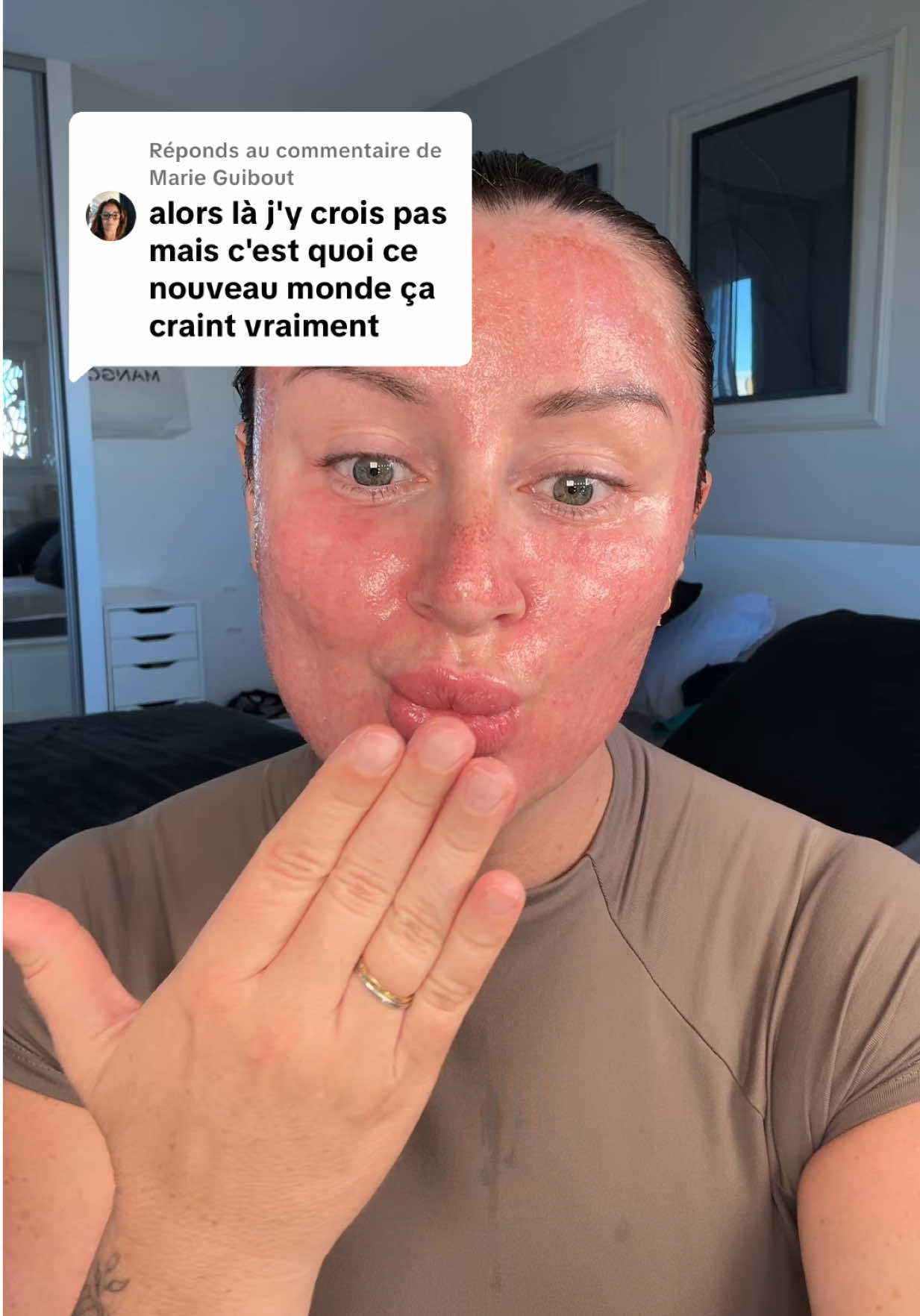 Réponse à @Marie Guibout Ma tronche de pizza et moi on te fait un gros bisous Marie. #laserco2 #laserfractional #peeling #skincare #skintok 