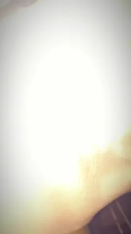 ASYMMETRICAL FACE☹️