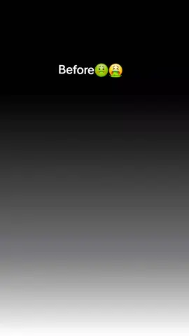 ga lagi deh rambut rontok🤪😍 #hairserum #rambutrontok #fyp 