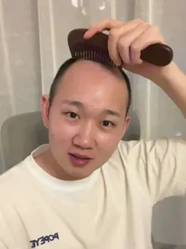 E là k thể#tienbarber #trihoidau #minoxidil 