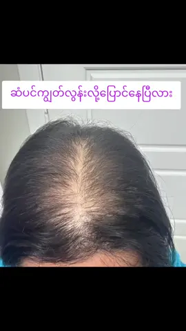 သဘာဝနည်းနဲ့ပြန်ကောင်းနိုင်ပါတယ် #haircare #shampoo #tkshampoo #myanmartiktok #fyp 