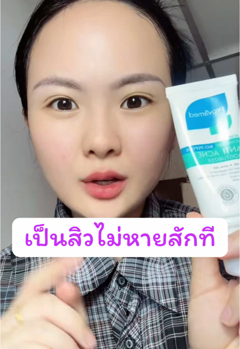 เป็นสิวซ้ำซาก  #มอยส์เจอร์กันสิว#มอยส์เจอร์โปรวาเมด  