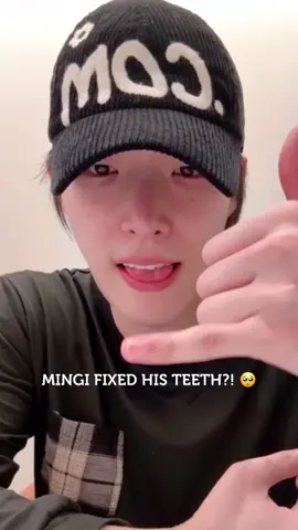 Im devastated he got hurt on stage today, and even more devastated he fixed his front teeth 🥺 it was so cute 😭 they’ll be missed 💖 Did anyone notice, or am I imagining things?!? I was watching the live he made after WB Macao and noticed something odd going on in his mouth 🫣 If it was an insecurity for him and makes him feel better I’m all for it, I just want him to be happy, always 🐥💛 #mingi #mingiateez #mingiwaterbomb #songmingi #mingisteeth 