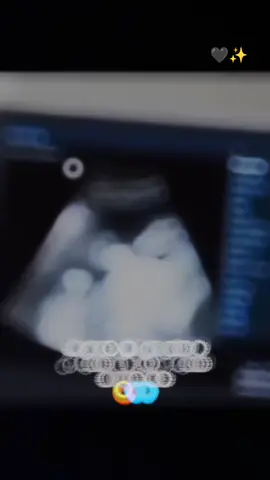 #في هذا اليوم #شو_معكم_بنوتي_ول_صبي💙 #حوامل_اي_شهر_صرتو_🤰🤰😍🦋 