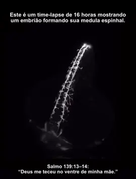 O corpo humano é a criação perfeita de Deus, cuide dele não como se te pertencesse, e sim como se pertencesse a o próprio Deus. Seu corpo é o teu templo. 🙏🏻 #god #deus #jesus #DeusÉFiel 