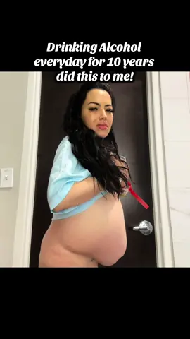 I now have one year sober, but still dealing with all the complications due to my drinking. #liver #cirrhosis  #sober  #WeDoRecover   #fyp