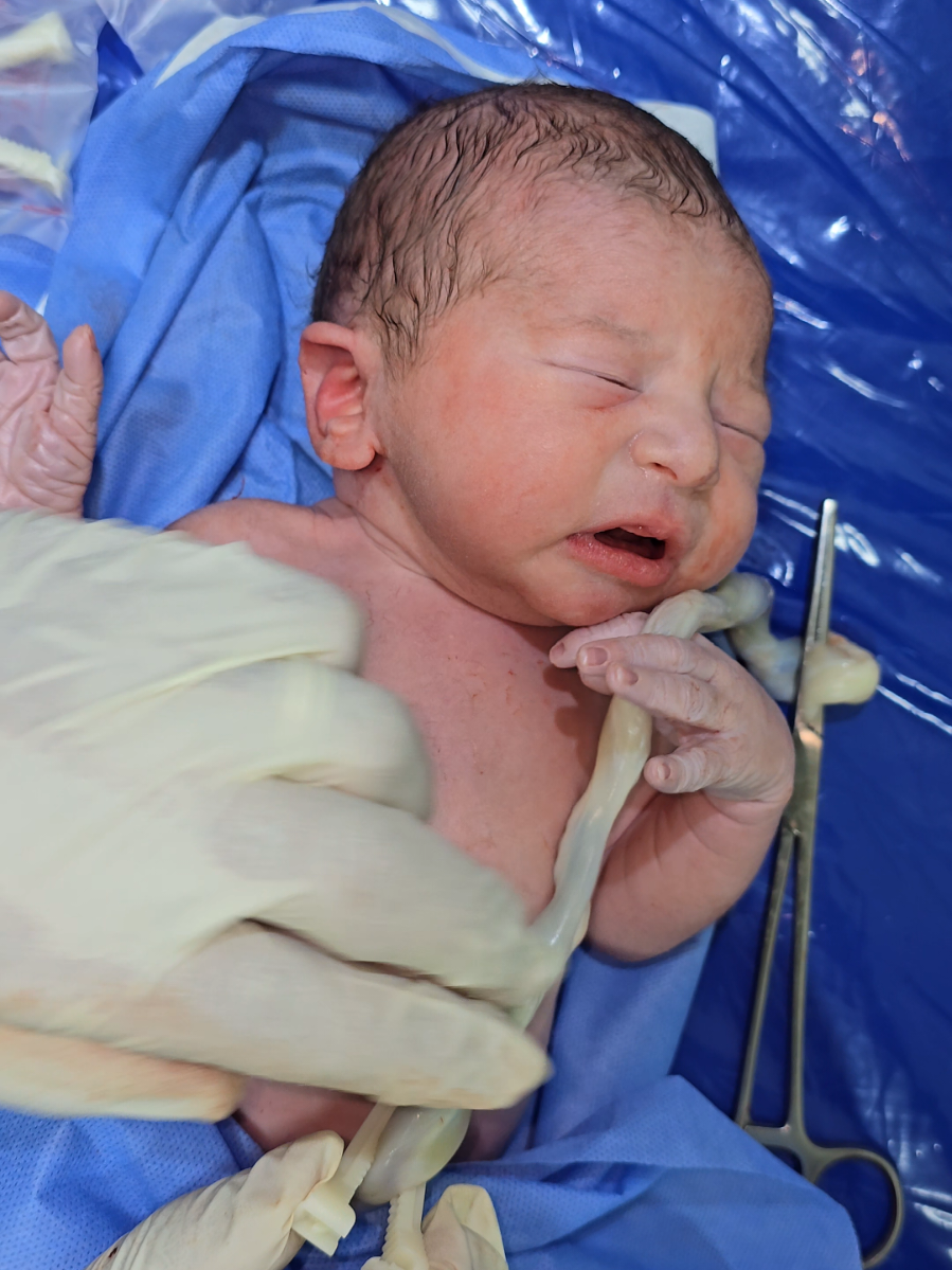 #cutebaby cord clamp 