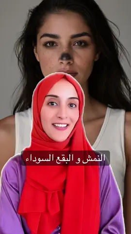 النمش و البقع السوداء  و التجاعيد #صحة #تغذية #santé #فوائد_صحية #fyp 