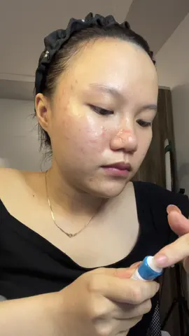 Hành trình vượt qua kiếp nạn dưỡng da ăn TẾT của em 🌼🤭#trimun #mun #goclamdep #xuhuong #vairal 