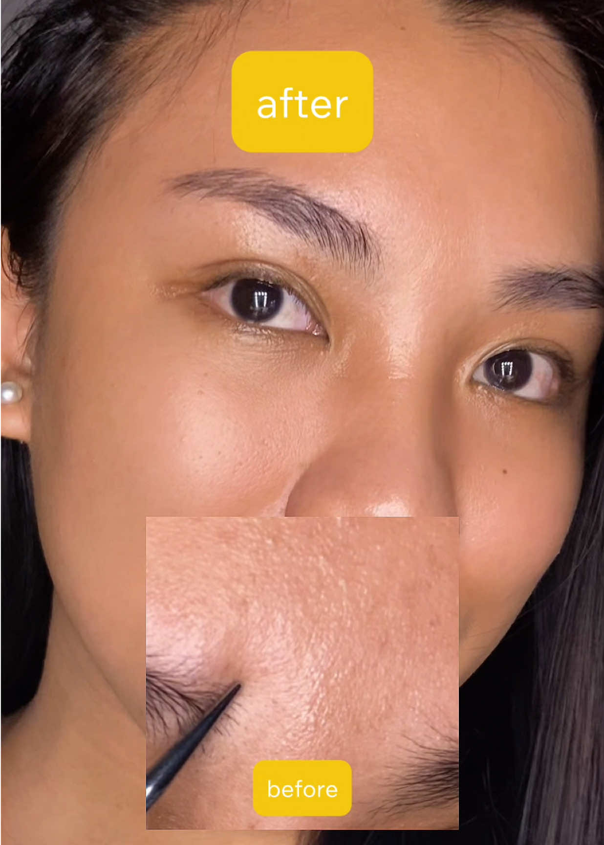 fine lines and wrinkles? i got it for youuuu ☺️✨ @KSECRET GLOBAL SEOUL 1988 ADVANCED SHOT: RETINAL LIPOSOME 12% + BLACK RICE Filled with 22,275 spicules that help deliver active ingredients deeper into the skin, promote cell turnover and refine pores for smoother, firmer skin. Gentle but yet effective! SEOUL 1988 Advanced Shot contains encapsulated Retinal to minimize irritation and deliver the benefits of retinal safely to deeper skin layers. it’s available in: Amazon, Stylevana, Stylekorean, Olive Young, YesStyle #GLOWSHOTCHALLENGE #KSECRET #seoul1988 #hyperpigmentation #darkspots