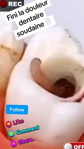 🦷Élimine les maux de dents en quelques minutes avec cette infussion miraculeuse🌿🌿💯 #santénaturelle #douleur #mal #foryoupage❤️❤️ #tiktokviral @tiktok creators 