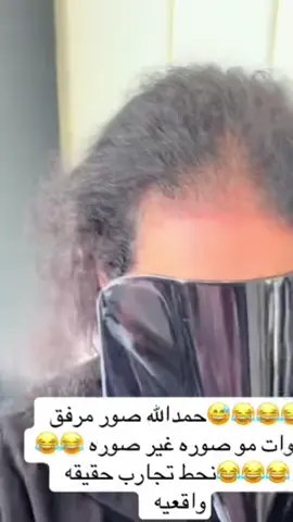 #trandyhair #خلايا_جذعية #الشعب_الصيني_ماله_حل😂😂 #اكسبلور 