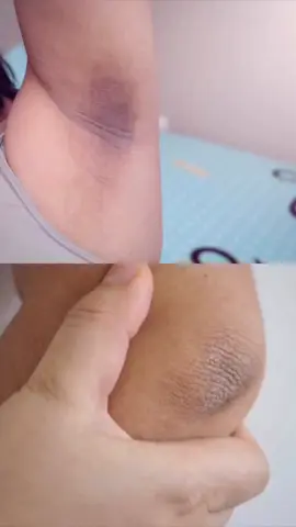 سرم آلفا آربوتین روشن کننده صورت  یک دست کننده رنگ پوست برای لک های پوست🌸👩‍🔬💗 #زیبایی_پوست  #درمانی_پوست  برای اطلاعات قمت دایرکت ❤🙏 #پشتون_تاجیک_هزاره_ازبک_زنده_باد🇦🇫 