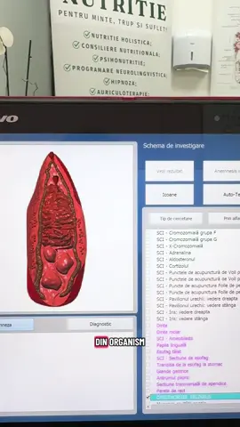 ✨Va astepam la TriSantos Clinic pentru o scanare cu aparatul de biorezonanta! Avem reduceri de Black Friday #sanatate #vitalitate #medicina #preventie #nutritie 