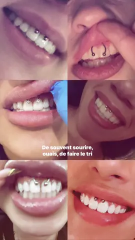 #fyp #smileypiercing 
