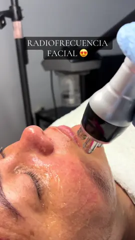 Existen ciertas contraindicaciones importantes a considerar, por lo que una valoración médica previa es fundamental. 🔴Embarazo y lactancia. 🔴Personas con marcapasos u otros implantes metálicos (placas, clavos) en la zona a tratar. 🔴Presencia de heridas abiertas, quemaduras o infecciones activas en la piel. 🔴Pacientes con antecedentes de cáncer de piel u otras enfermedades malignas. 🔴Personas con epilepsia o diabetes (en algunos casos, requiere precaución).  #radiofrequency #papada #arrugas #flacidez #pielfirme 