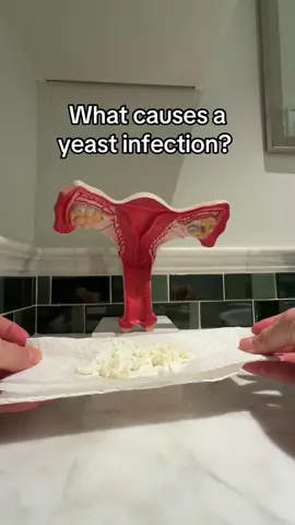 What other questions do you have about yeast infections? #candidaalbicans #candida #candidaglabrata #yeastinfection #creatorsearchinsights 