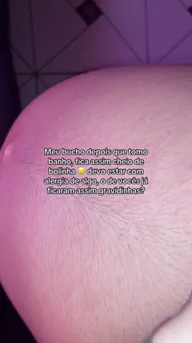 Tiveram essa alergia na gestação? #gravida #viral #gravidasnotiktok #maeprimeiraviagem #maternidade 