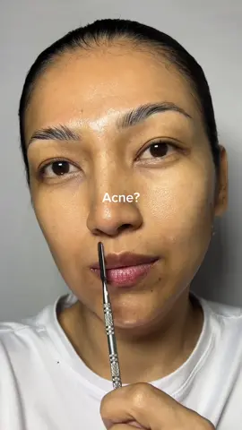 Acne???  This Cream 👇🏻 💚Mighty Bamboo Panthenol Cream: post acne mark recovery ✨ @PURITO SEOUL  #Purito #PanthenolCream #RealPostAcneCream #Koreanskincare #NoMoreMarksChallenge 