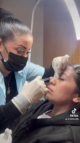 Ácido hialurónico en nariz 