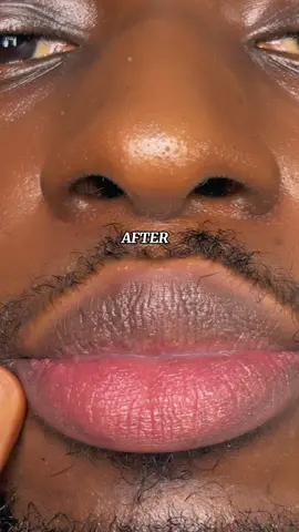 20% Niacinamide for lip pigmentation in just 7 days? @Jumiso Global  #fyp #goviral #jumiso #koreanskincare #skincare 