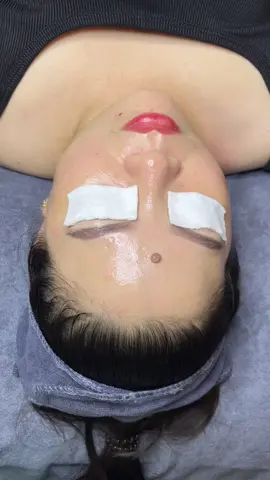 ca căng bóng nha e . #Trangspa #duocmypham #dieutrimun #trietlongvinhvien 