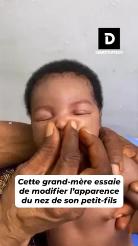 Dans certaines cultures, les standards de beauté influencent les préférences locales, notamment pour les traits du visage. Certaines familles peuvent adopter des pratiques, parfois très discutables ou dangereuses, pour que leurs enfants “ressemblent” à ces idéaux. Dans tous les cas, pincer le nez d’un enfant pour changer sa forme est dangereux et non recommandé, et serait considéré aujourd’hui comme une forme de maltraitance si cela cause douleur ou dommages.