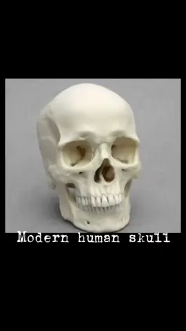 As pessoas não entendem que entre a ração do governo e a dieta primitiva ou da selva,chamem como quiser, a dieta primitiva tem muito mais benefícios em questões de saúde, hormônios, dimorfismo masculino e maturidade dos ossos que são o que realmente vão te tornar bonito, mas tem um porém todos seus ossos faciais só terminam de se desenvolver aos 25 anos, então se você tem mais que isso, não iria melhora-los há não ser com cirurgias mas com certeza não vai ser mais um estrogenado do sistema, um exemplo que temos de o que é realmente bonito é kanasa o tribal não miscigenado mostrado na Edit e o outro que é favorecido pelo eurocentrismo ele não é bonito e nem saudável,Blud só é branco, você nota no rosto dele que ele é muito mais feminino, justamente por uma infância,adolescência e uma vida adulta com má alimentação, são todos sinais de baixo dimorfismo masculino, acabou para MTN com coloração e female gaze.  #looksmaxingbr #looksmaxing #looksmatch #lookism #mulherdepreso🔓🕊👫💍  @brandini.pirata @Brandini.selva @Soubelarmino2 @mone123 @jessikamartinsalt 