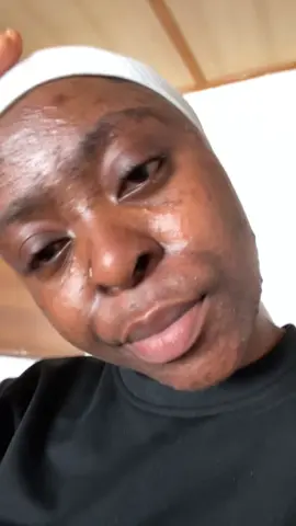 Still healing ❤️‍🩹 #acnejourney #selflove #isotretinoin #glowupstory #fyp 