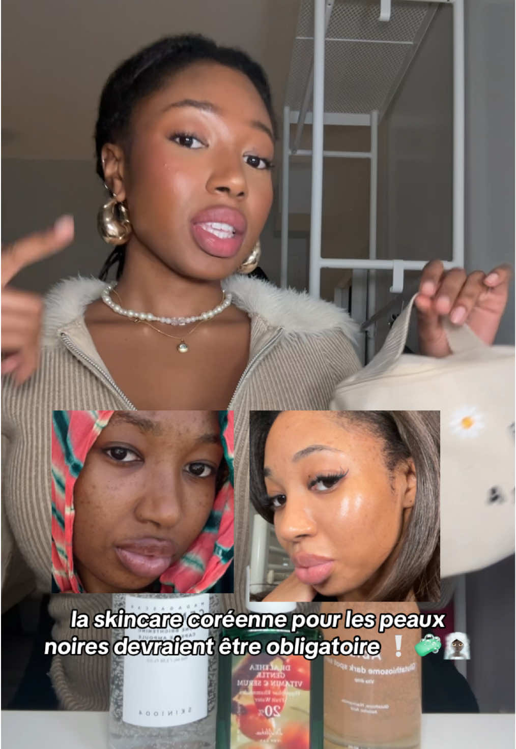 pourquoi la skincare coréenne est la meilleure pour les peaux noires et métisses ❕🧼  ig : alohamaera 🩷 #skincare #skincarecoreenne #kbeauty #hyperpigmentation #peaunoire 