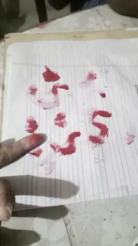 হাত কেটে আঁকতে চেয়েছিলাম   S আর এটা কি হলো 🥲💔