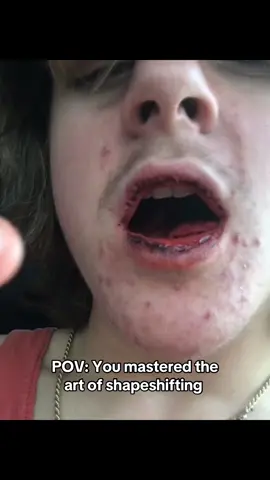 Everything has been feeling difficult lately. It feels like I’m loosing my ability to accomplish anything at all. Even the smallest task that would take one minute, I just never start. I have no motivation to even show up to classes or get anything done. Even my own hobbies and passion are being forgotten. The continuous feeling of being exhausted won’t leave. And all I can seem to do is mope around #debloat #transformation #qanyon #growingup 