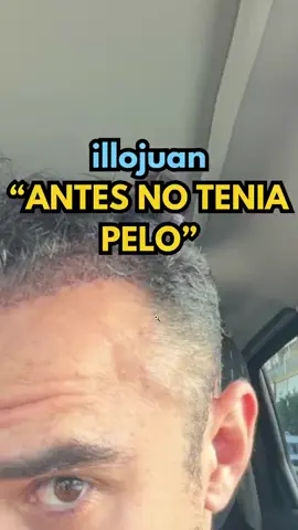 illojuan habla de su injerto de PELO #illojuan #clips #tik_tok  #parati #fyp 