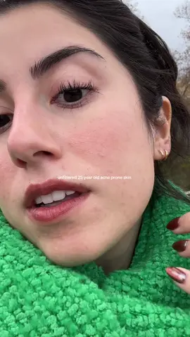 she’s a little bumpy and dry but that’s okay 🥰