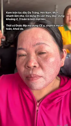 #kemtron #ruouthuoc #corticoid 