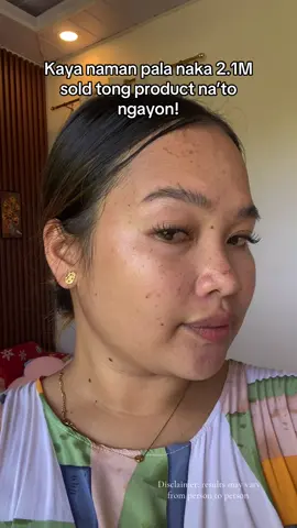 Grabe yung progress nya😭🥰#dermorepubliq #whiteningserum #trendingserum #dermorepubliqserum #dermorepubliqniacinamideserum 